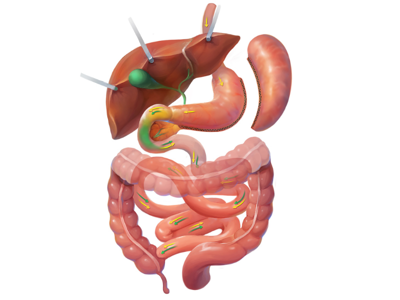 >How The Gastric Sleeve Works